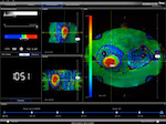 MRI timeline